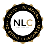 Tattoo Removal No Sting Guarantee by Next Level Clinic