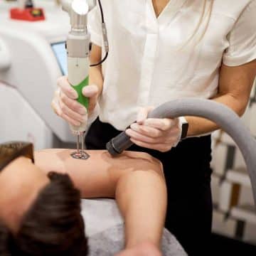 Experienced tattoo Removal Therapists